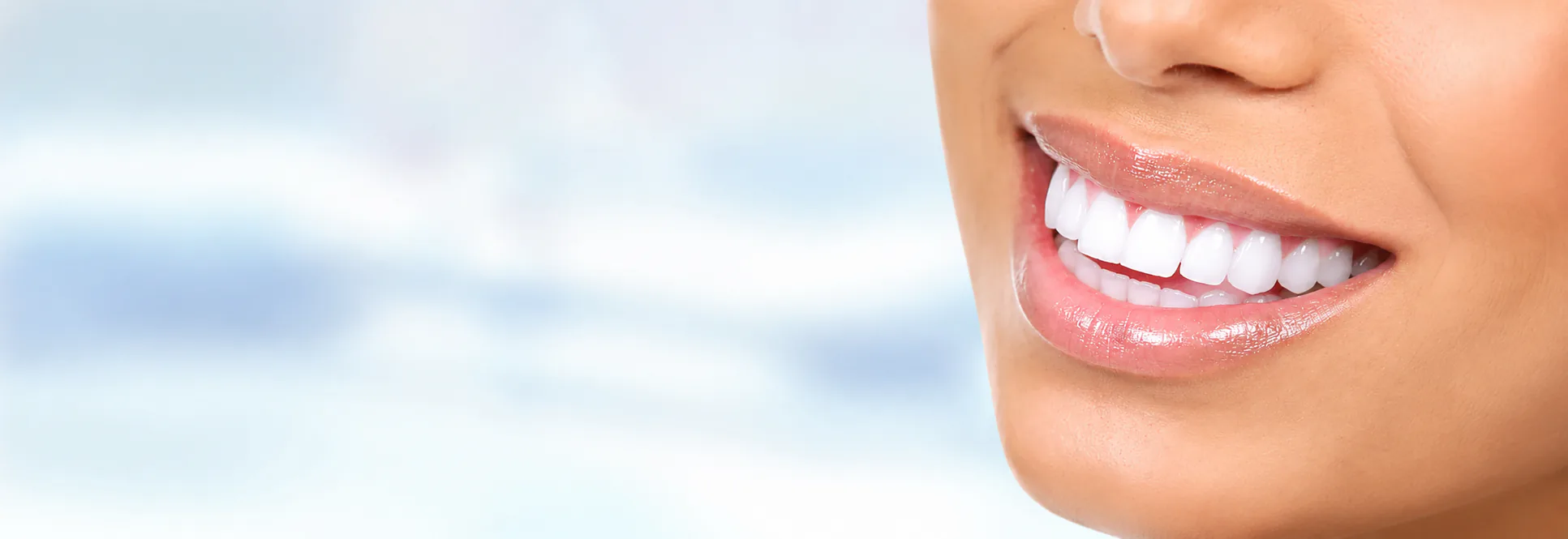 Close up smile white teeth — Teeth Whitening at PermaSmile! in Ottawa