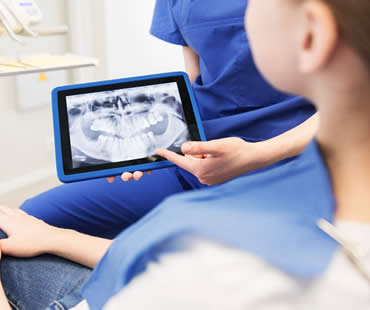 Oral Surgery: Extracting Impacted Wisdom Teeth