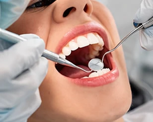 Professional Cleanings at PermaSmile! in Ottawa