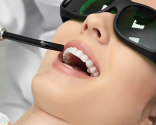 Laser Dentistry