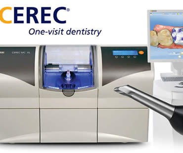 CEREC: The Answers to Frequently Asked Questions